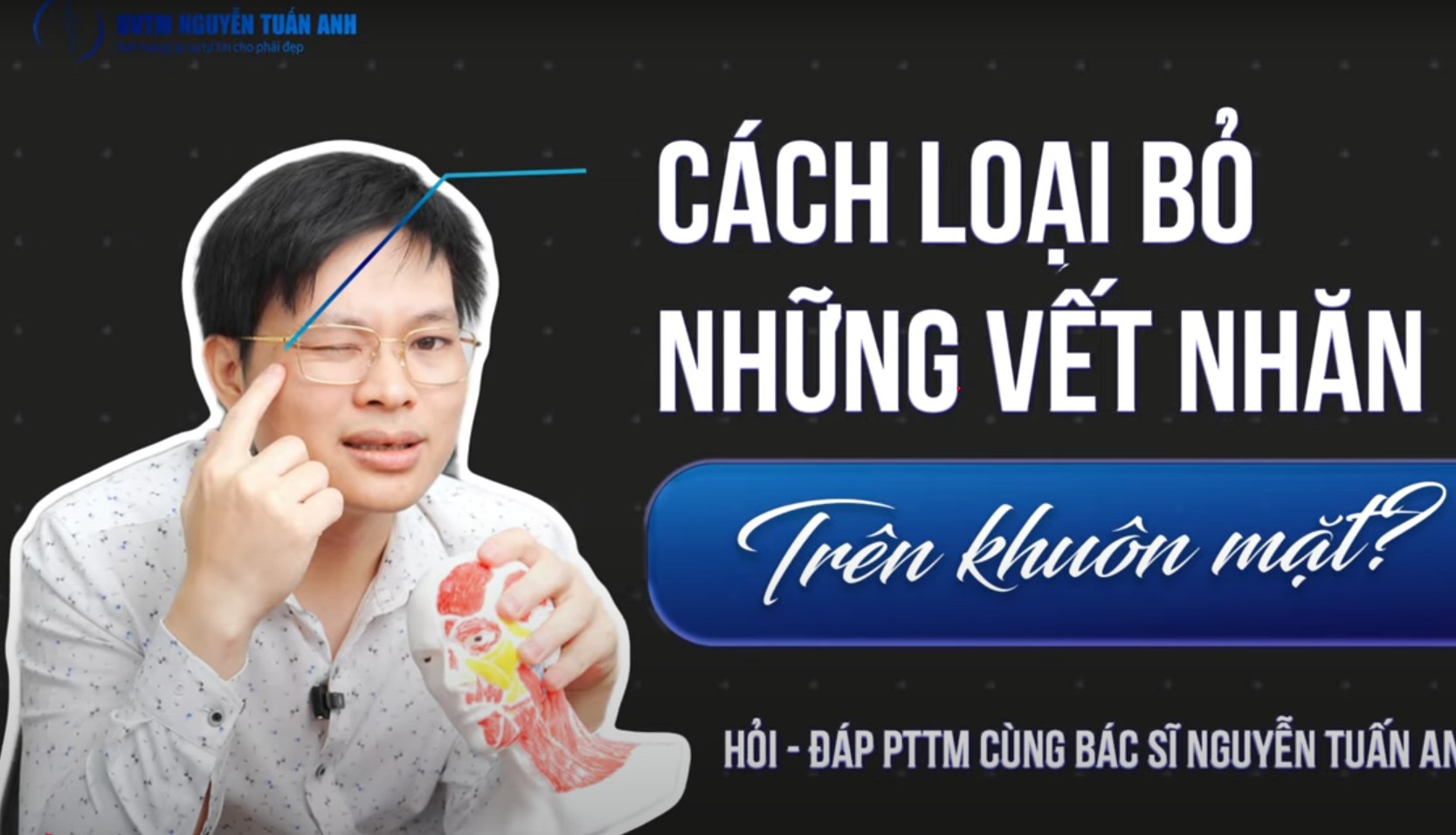 Nếp nhăn trên khuôn mặt